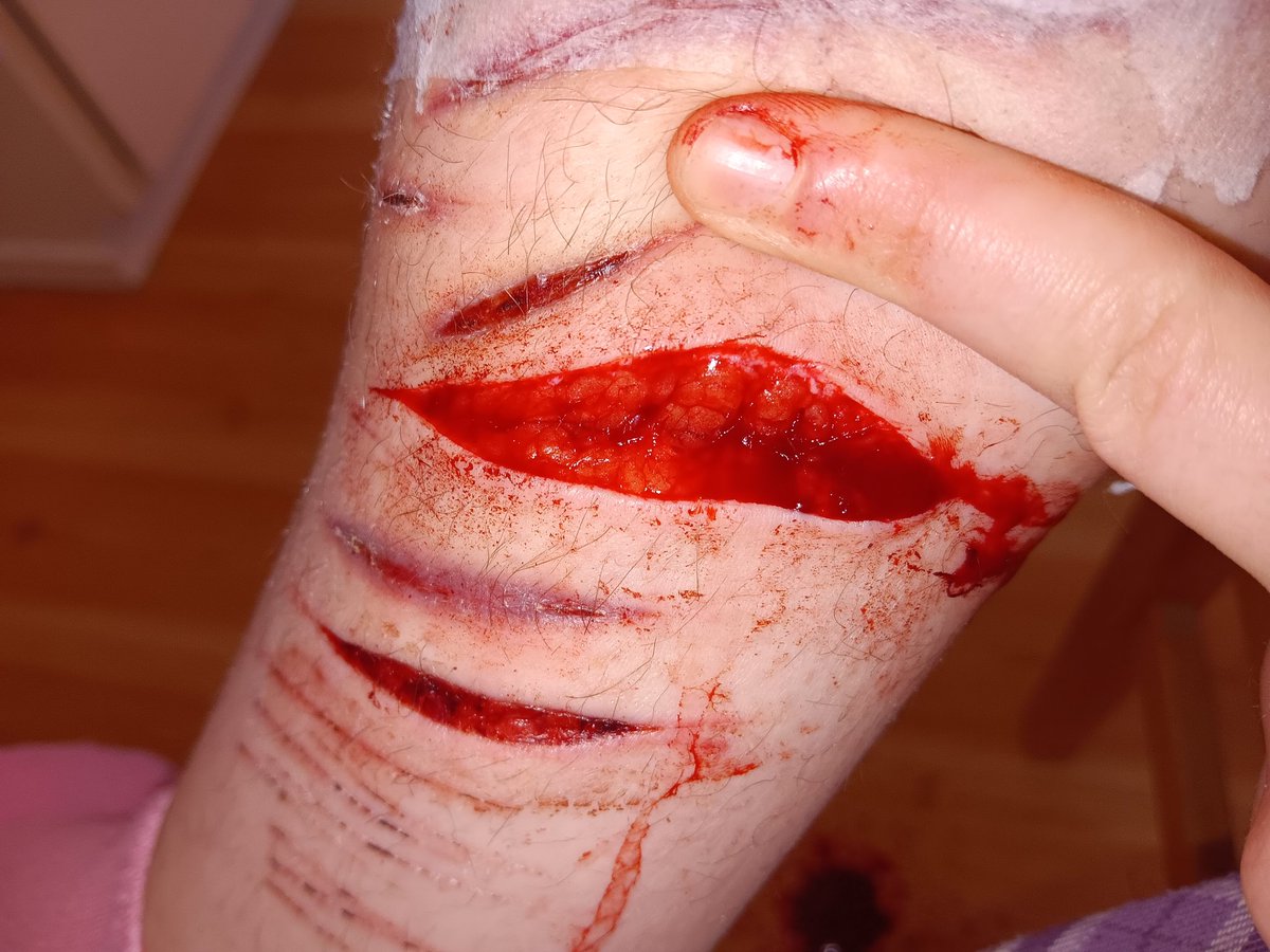 chocolatehurtstopurge tweet media