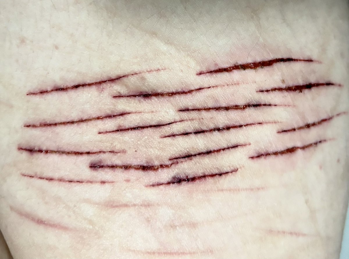 ♱⋮ᴺᴵⱽᴱᴷ tweet media