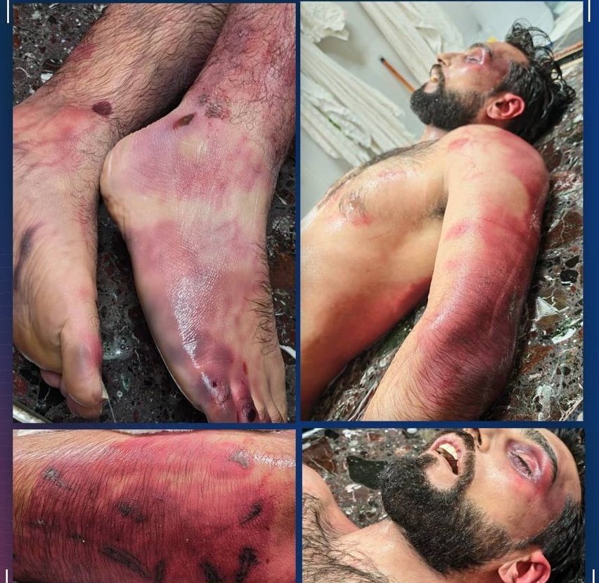 Aly_Thaair's tweet photo. Mohammed Al-Mousawi will always be remembered as The martyr of Al-Quds, whose unjustly shed blood further strengthens the continuity of Bahrain's freedom from this cruel and oppressive monarchy.
#FreeBahrain https://t.co/Zq4ucCv2Ke