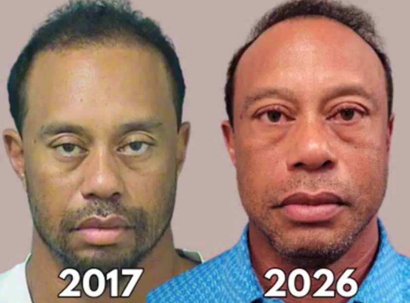 Aliano256's tweet image. 🚨 TIGER WOODS DUI MUGSHOTS — SOMETHING ISN’T RIGHT 

Both times:

• Arrested for DUI
• Blew 0.00

Same story.
Nine years apart.

Look at his eyes.

What do you see?