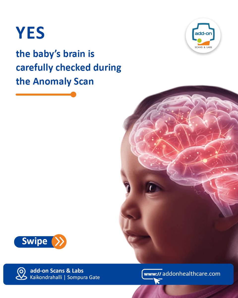 addonscans's tweet image. 🧠✨ 𝐃𝐨𝐞𝐬 𝐚𝐧 𝐀𝐧𝐨𝐦𝐚𝐥𝐲 𝐒𝐜𝐚𝐧 𝐂𝐡𝐞𝐜𝐤 𝐘𝐨𝐮𝐫 𝐁𝐚𝐛𝐲’𝐬 𝐁𝐫𝐚𝐢𝐧? 🤰💙 #addonhealthcare #anomalyscan  #NayeUPKiUdaan #HistoricAmaravatiResolution #dhirendrasinghjewar #NayeBharatKaNayaUP