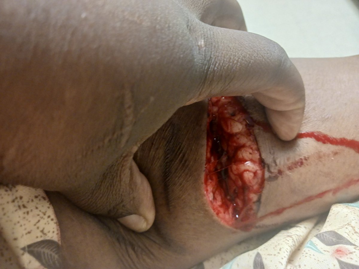 ✨️🍎PrincelyED🍎✨️ (4. 5/38lbs) tweet media