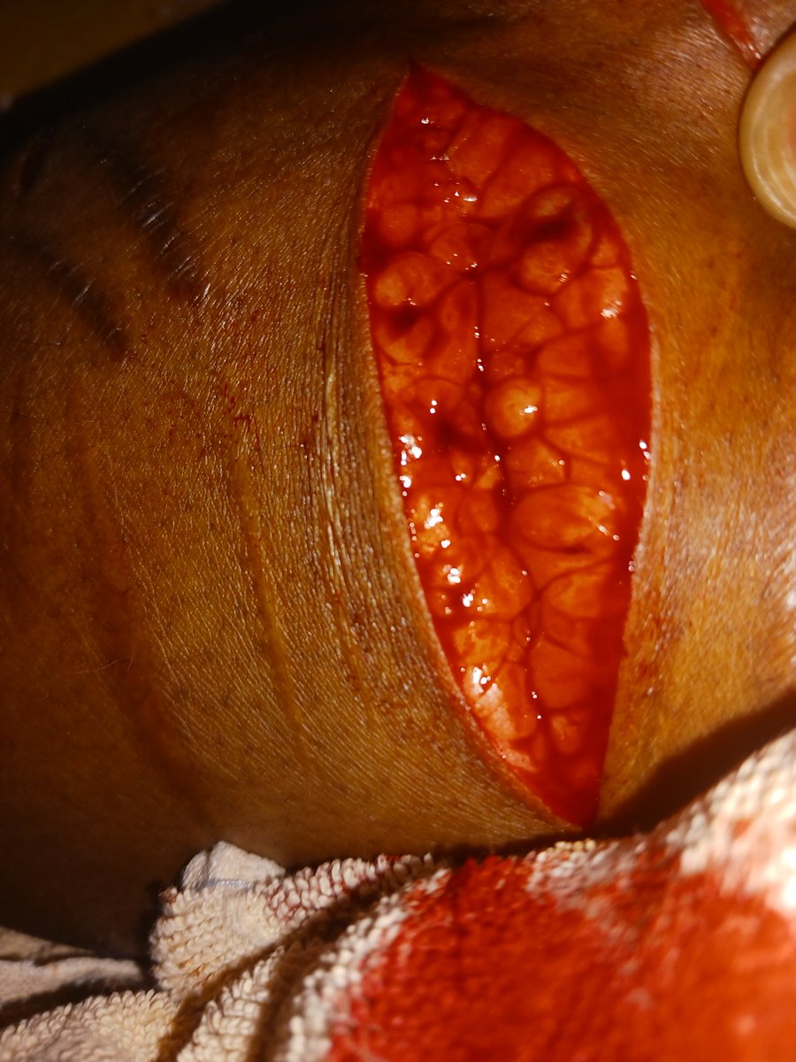 ✨️🍎PrincelyED🍎✨️ (4. 5/38lbs) tweet media