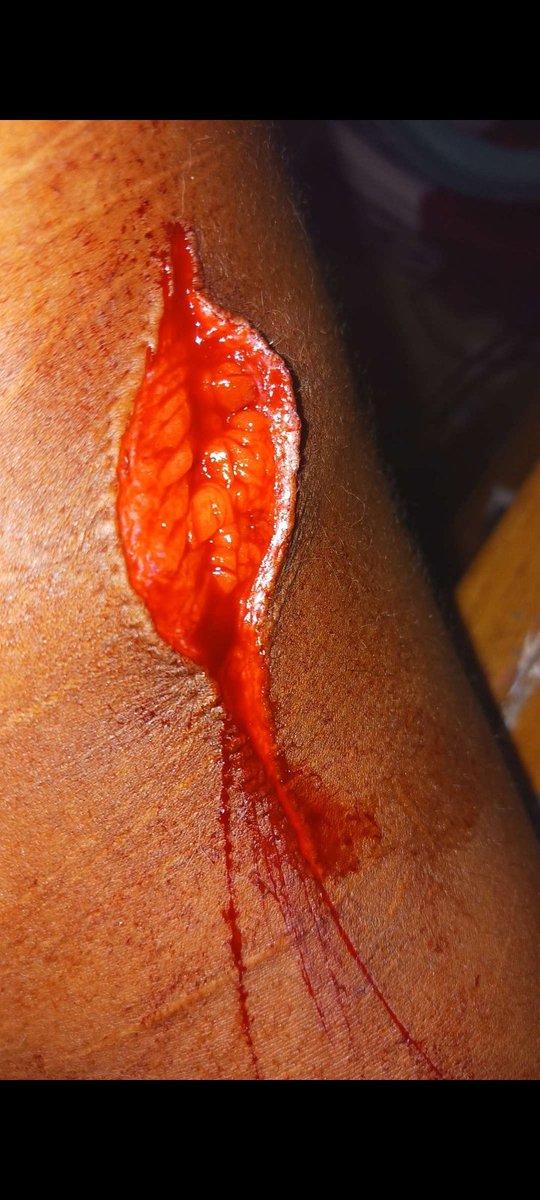 ✨️🍎PrincelyED🍎✨️ (4. 5/38lbs) tweet media