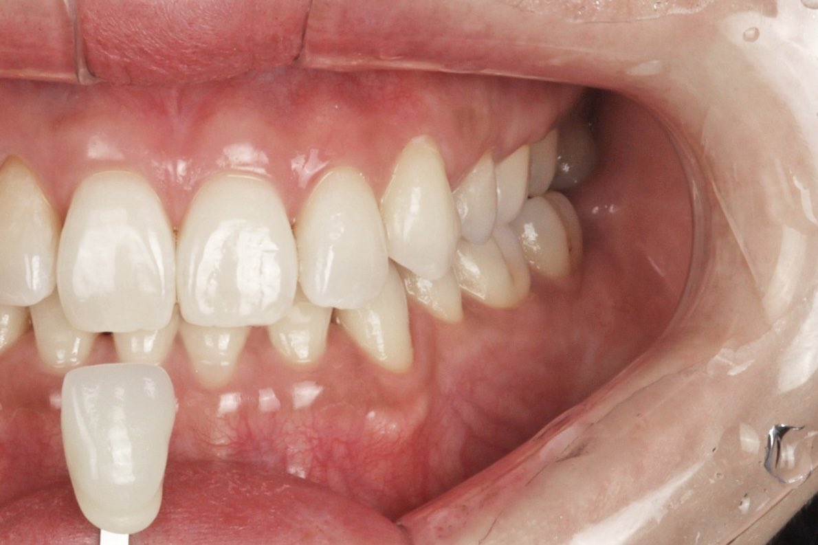 アラフォー韓国美容🇰🇷 tweet media