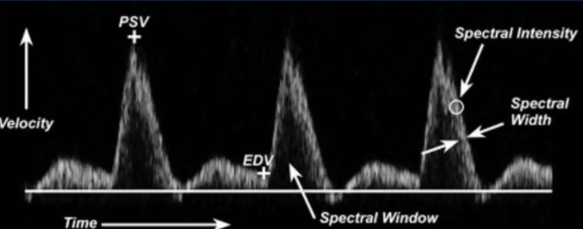Spectral window vs spectral broadening!! Clean and uniform laminar flow ...