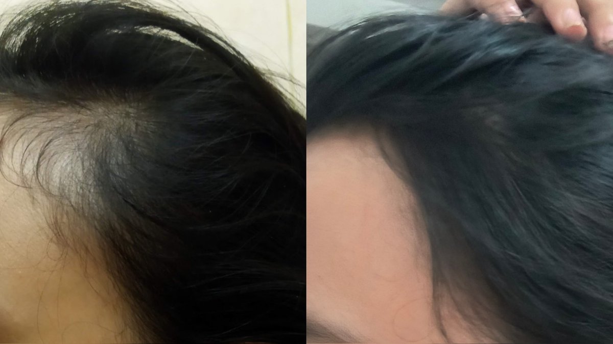 poetrysomers tweet media