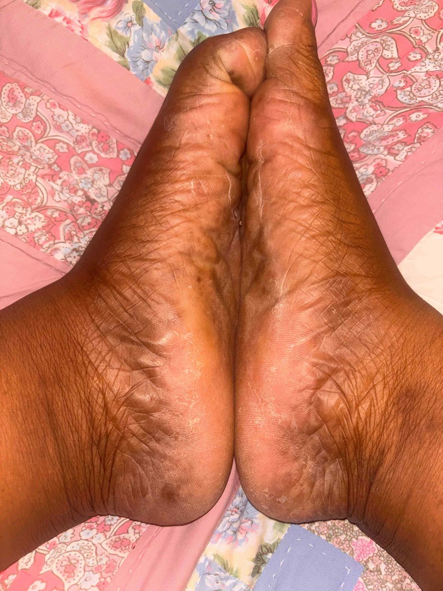 KQuingfeet's tweet photo. Lick in between my soles 
@rt_feet https://t.co/G3G0TDpQ25