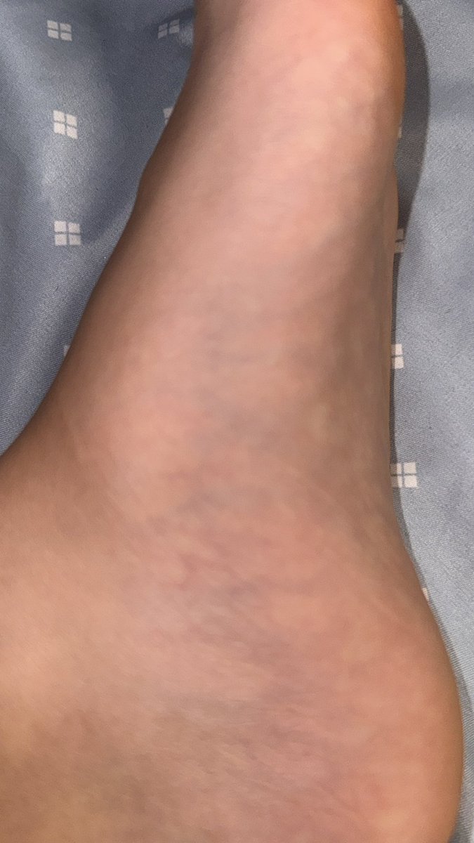 Michael Kaiser of shedtwt tweet media