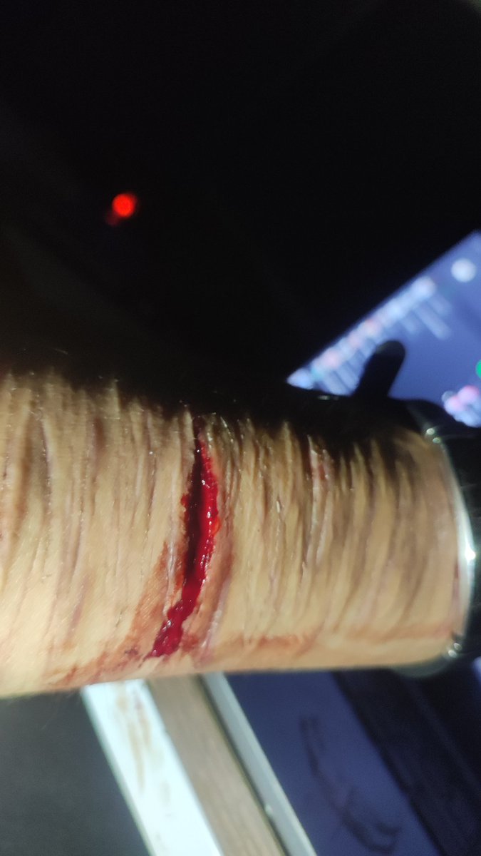 eLizolam tweet media