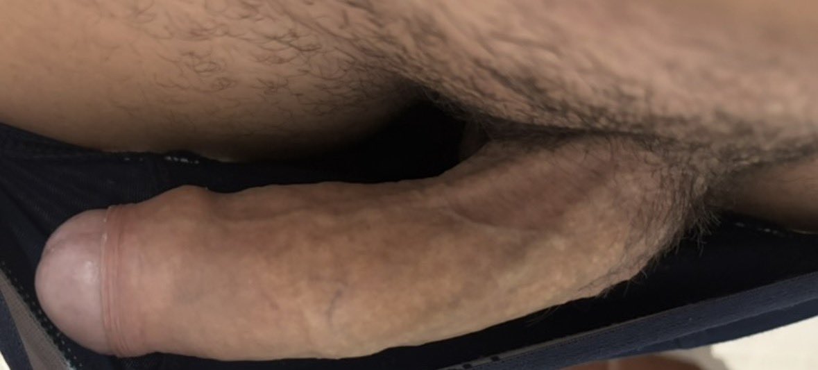 Alpha Fierum tweet media