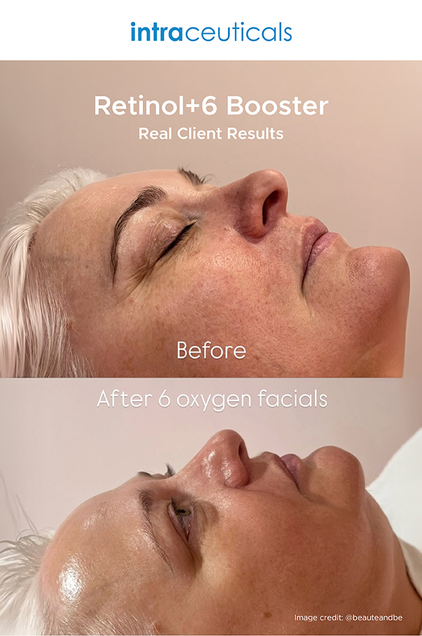 JM_BEAUTY5 tweet media