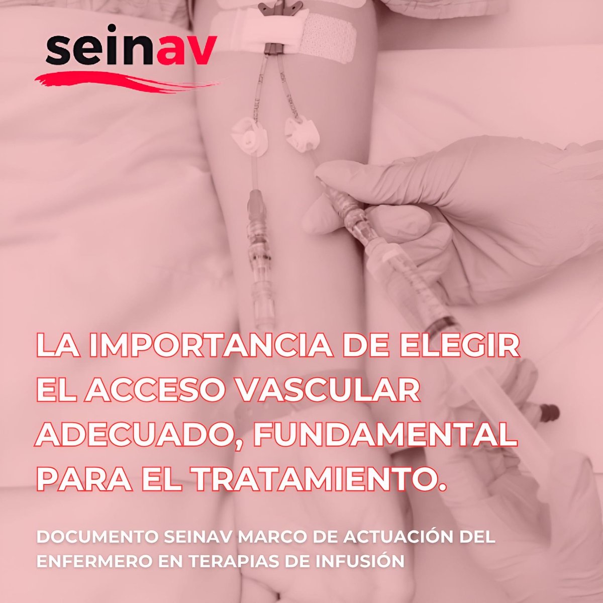 Sociedad Española de Infusión y Acceso Vascular tweet media