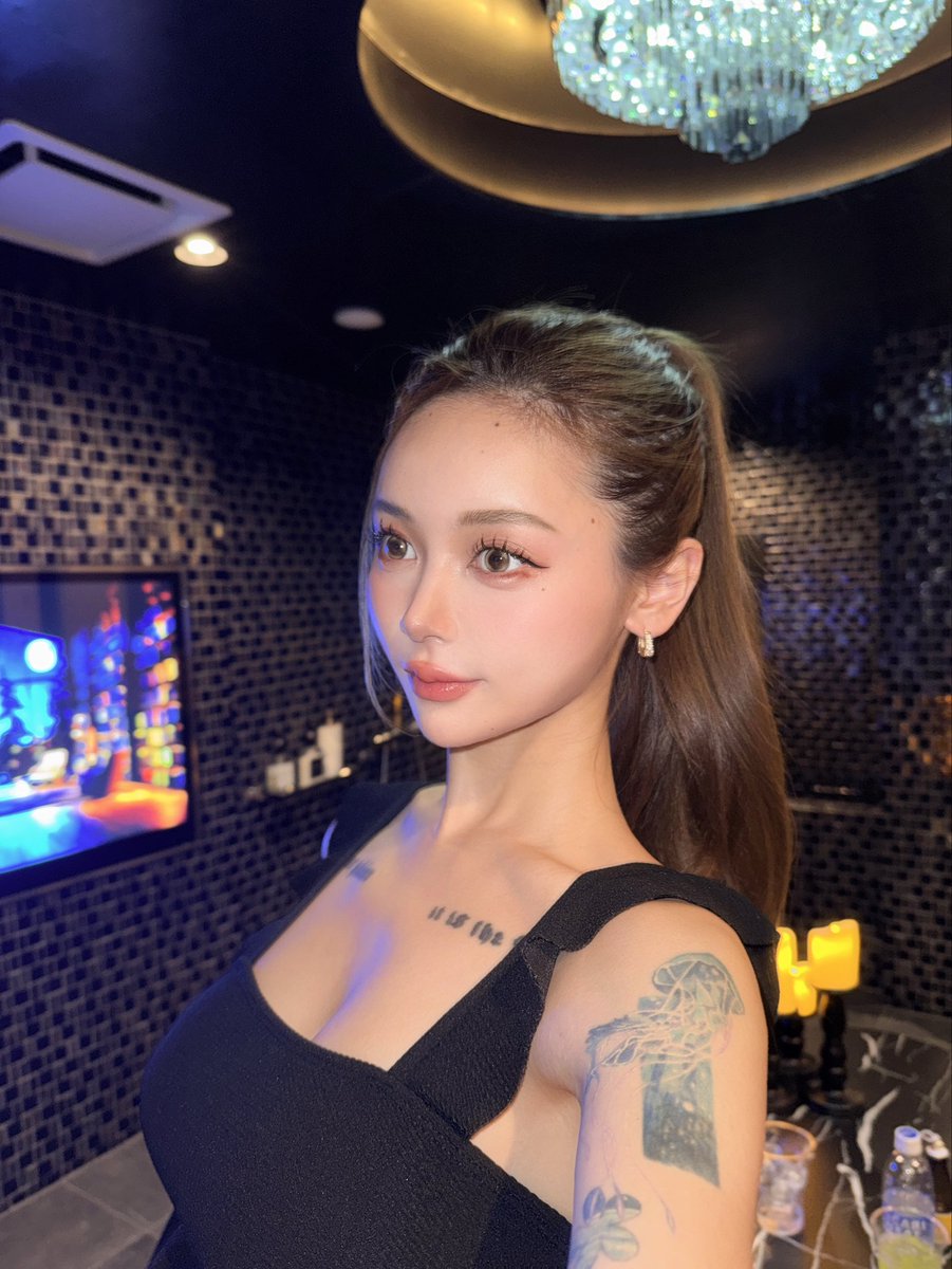 dwgran_'s tweet photo. Firstclinicの朝野先生今回もDTめっちゃ少なかったし
絶妙な量の脂肪を必要な分だけ取って引き上げてくれて
やはり天才だなと再度思った🥺
メニュー:顔の脂肪吸引(ジョールファット)・糸リフト　@dr_asano_tomo https://t.co/EIaoqSdEqe