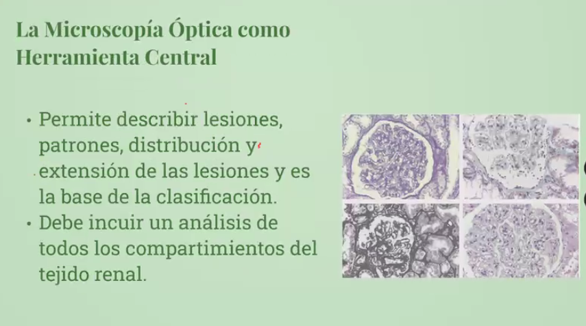 LilianCVillalba's tweet image. 🏡💡🔬La #MicroscopíaOptica es una herramienta central.
💡🔬#MET en niños es importante en #LCM #SmedeAlport
💡La interpretación final de la biopsia es del nefrólogo. Dra Paula Segura 🇨🇱 #SeminariosNefroJuniors #Alanepe