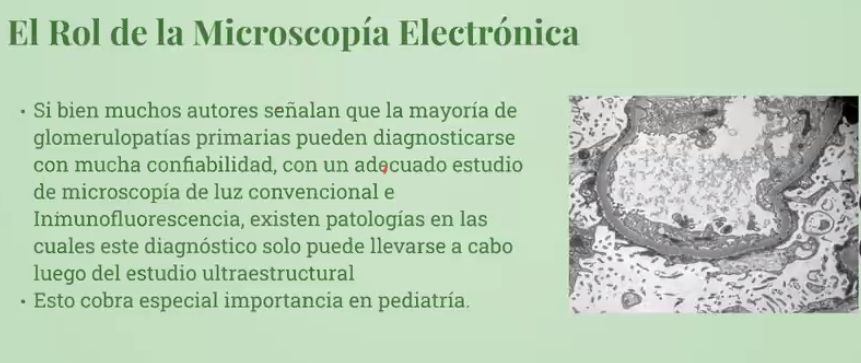 LilianCVillalba's tweet image. 🏡💡🔬La #MicroscopíaOptica es una herramienta central.
💡🔬#MET en niños es importante en #LCM #SmedeAlport
💡La interpretación final de la biopsia es del nefrólogo. Dra Paula Segura 🇨🇱 #SeminariosNefroJuniors #Alanepe