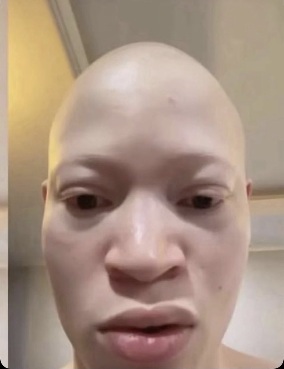 Osamudiame tweet media