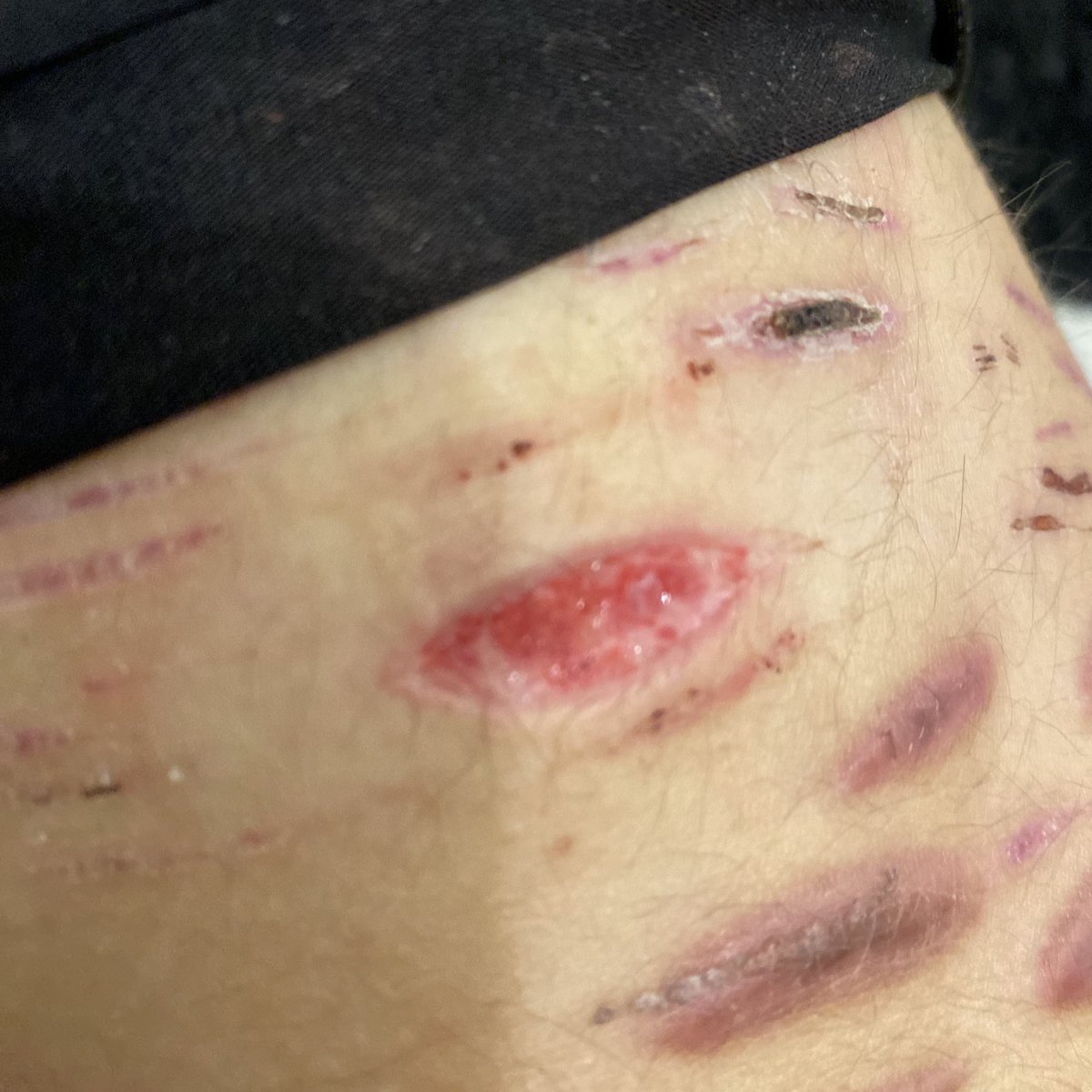 KEL ★ || shtwt tweet media