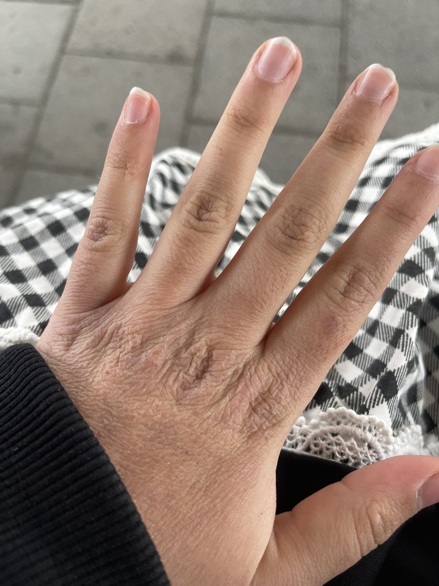 𝜗𝜚 Mio 🍍🧽 tweet media