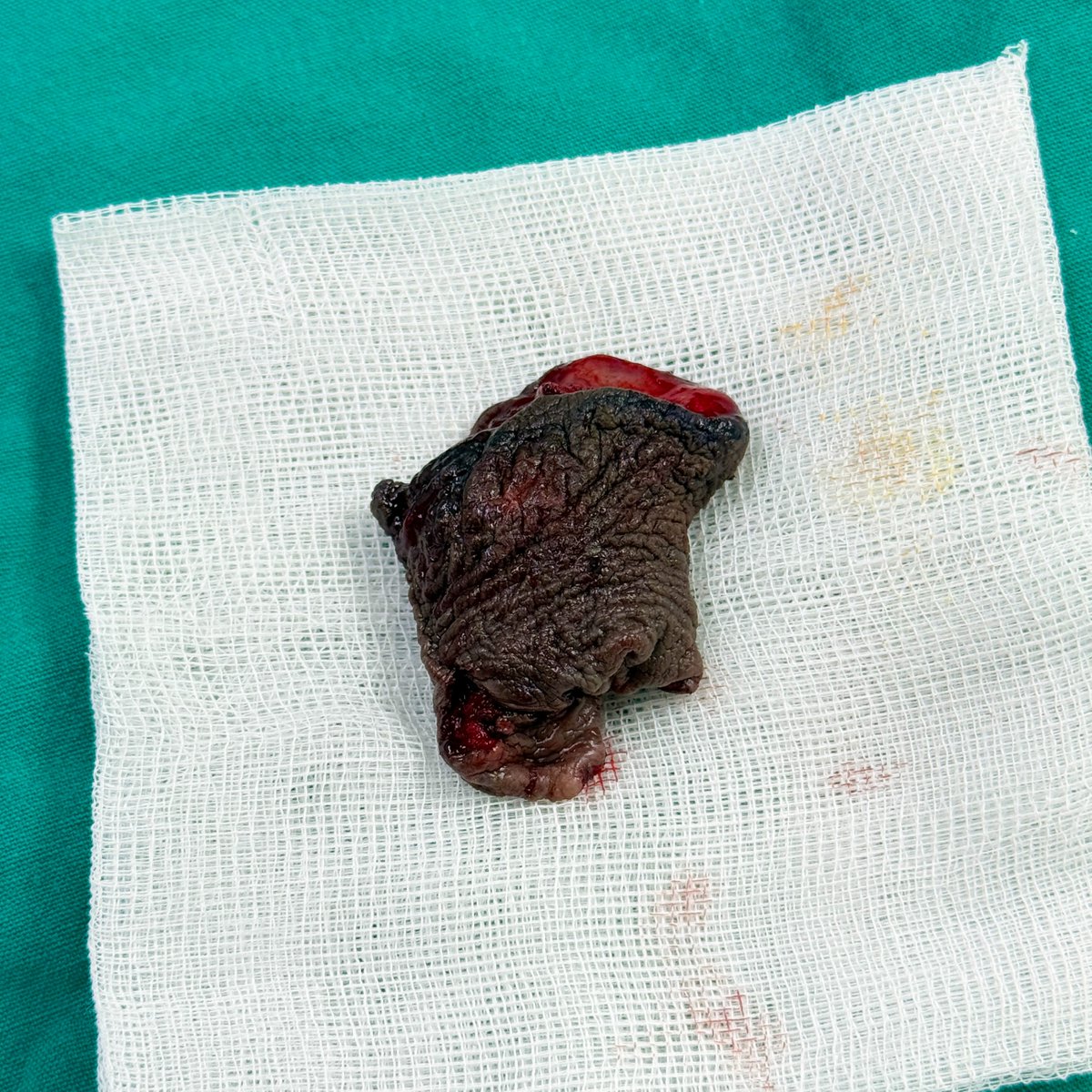 Dr.Nut Jirawee tweet media