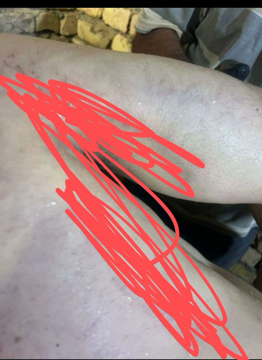 بندر الحسيني tweet media