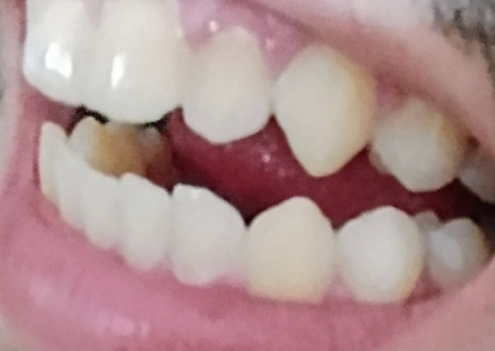 Interno ClinicoCirurgico (Emergencista) tweet media