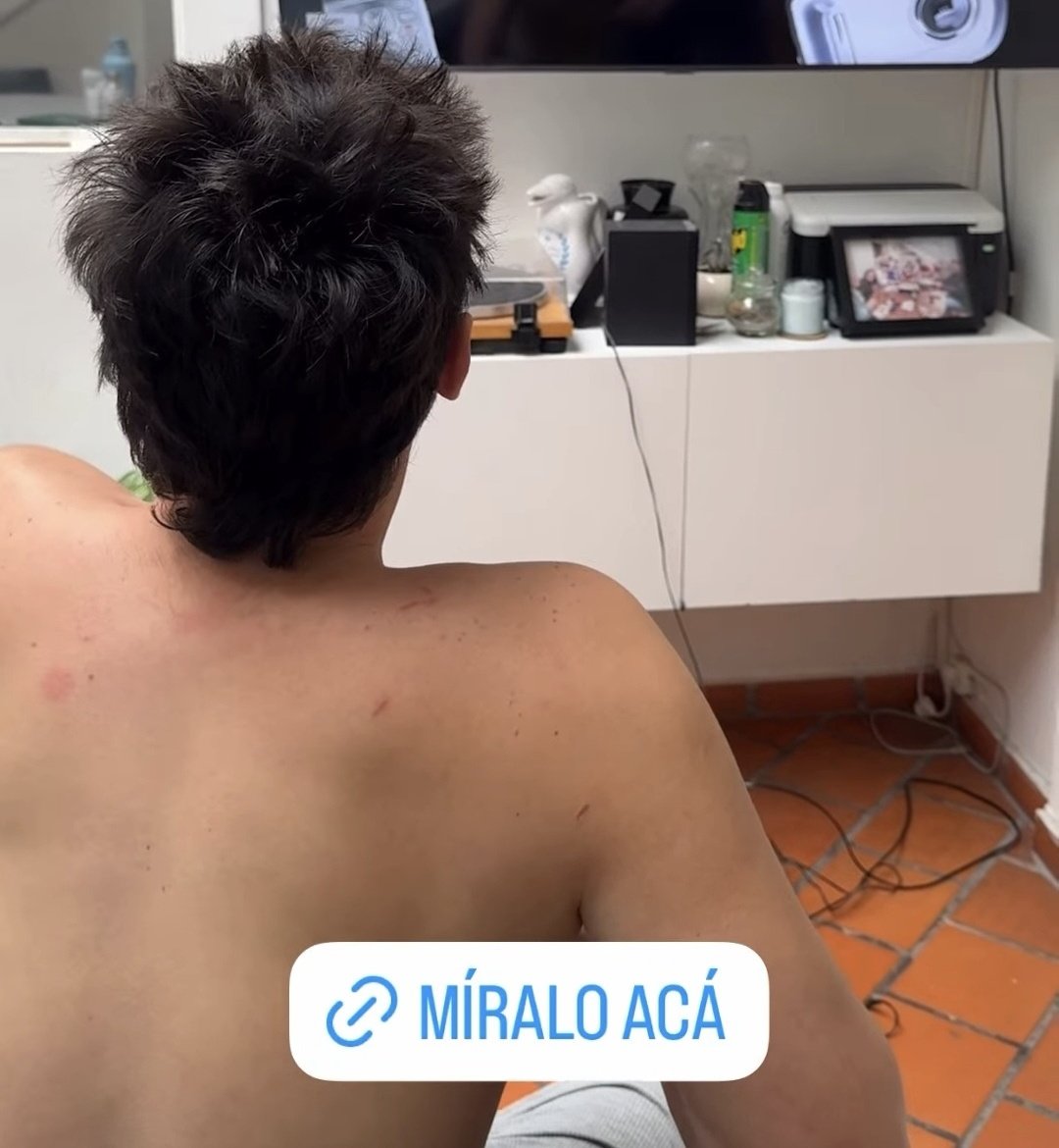 catalina5803401's tweet image. Ferbo esta disfrutando bien su solteria jajajajajaja esos arañazos no son de domi creo che 
Con razon domi se atajaba anoche diciendo que puede que los vean con otros 
No sufran ferbomis sean felices que su favorito lo esta siendo😏
#SeFueLarga