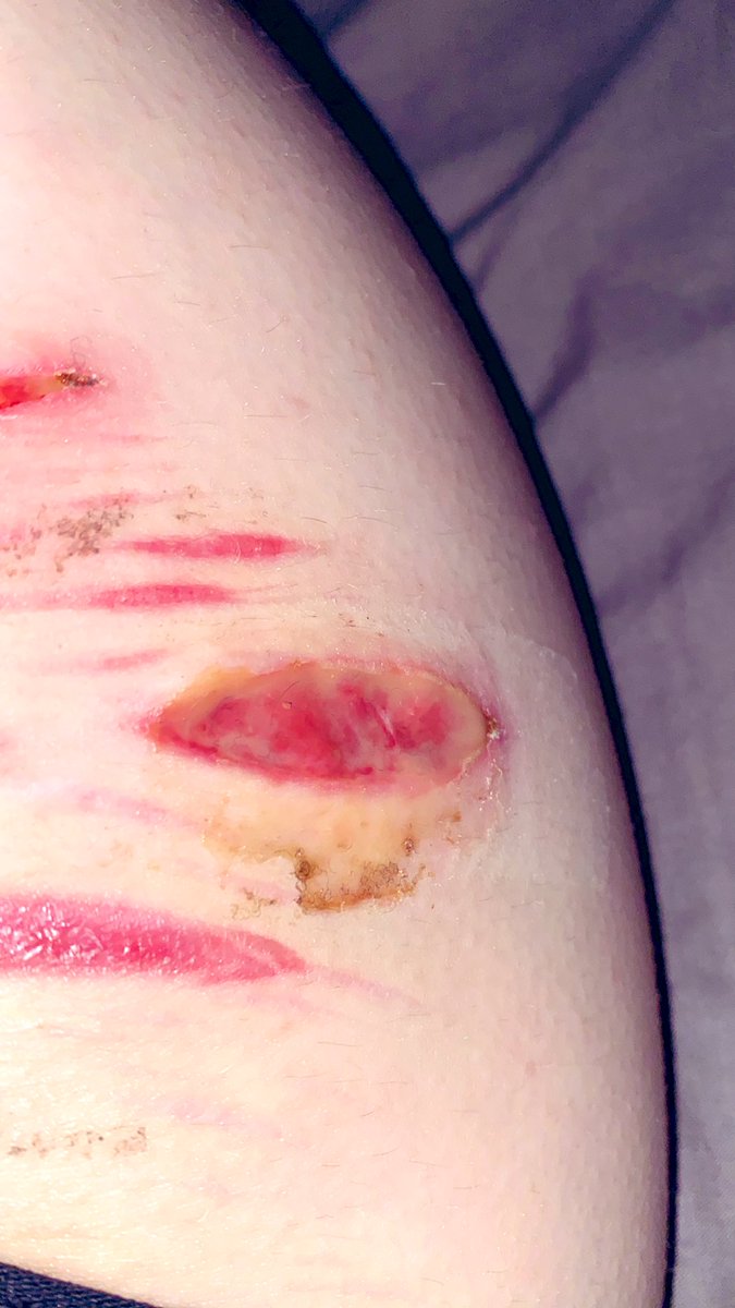 °•Evil Renny•°|Will Byers| tweet media