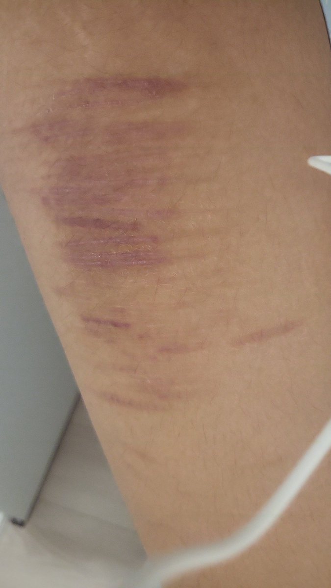 Lawliet's space tweet media