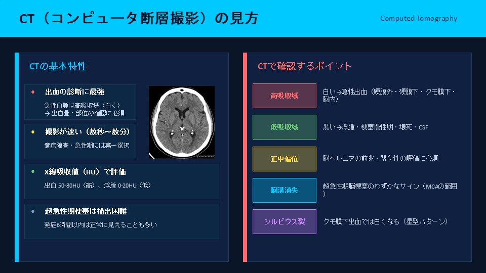 yutarojpt6's tweet photo. 【脳画像の読み方】
CT・MRIの見方についてまとめてみました。 https://t.co/vmRNqlQ5UB