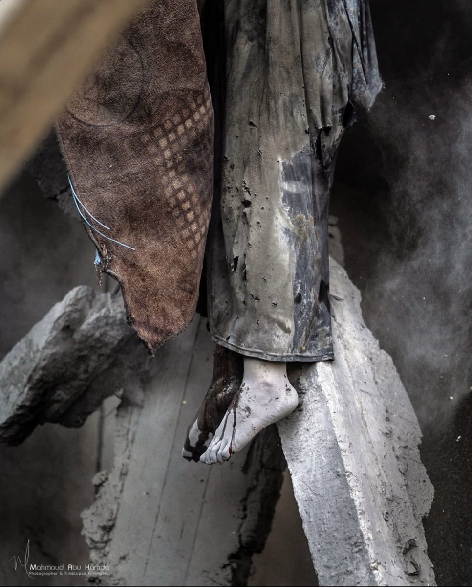 Dr.Hamza Alsharif 🇵🇸 tweet media