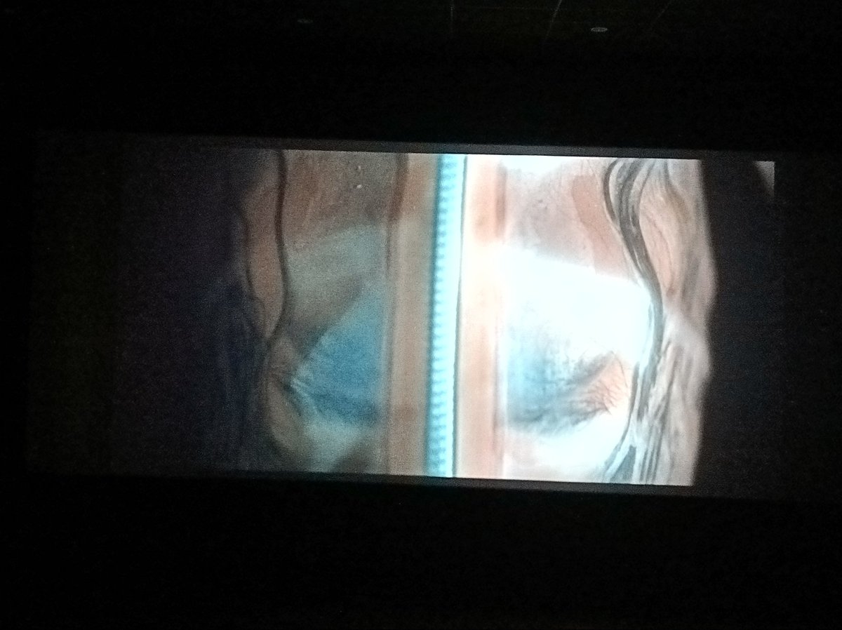 COLOMBO (peanuts era) tweet media