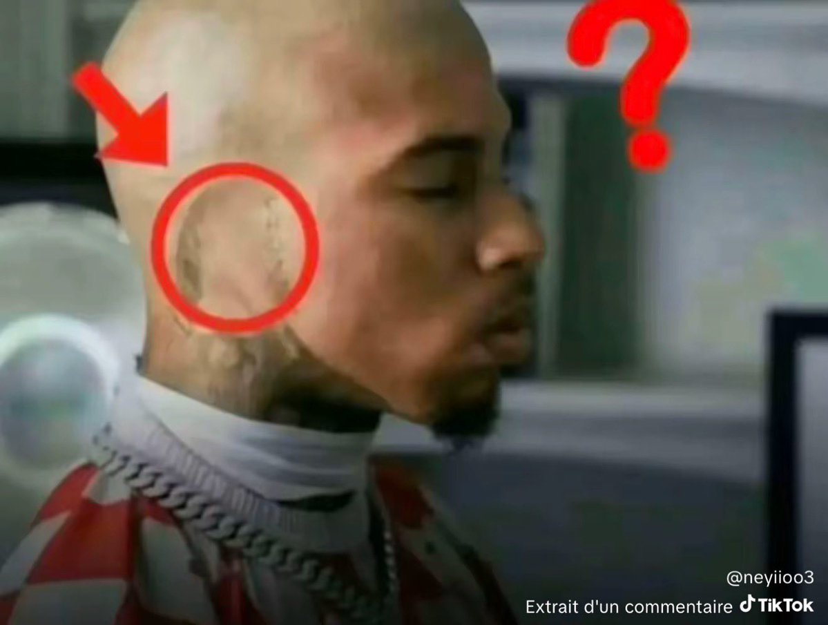 🔴⚪️ tweet media