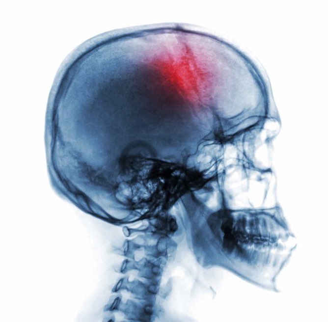 Indie 505 tweet media