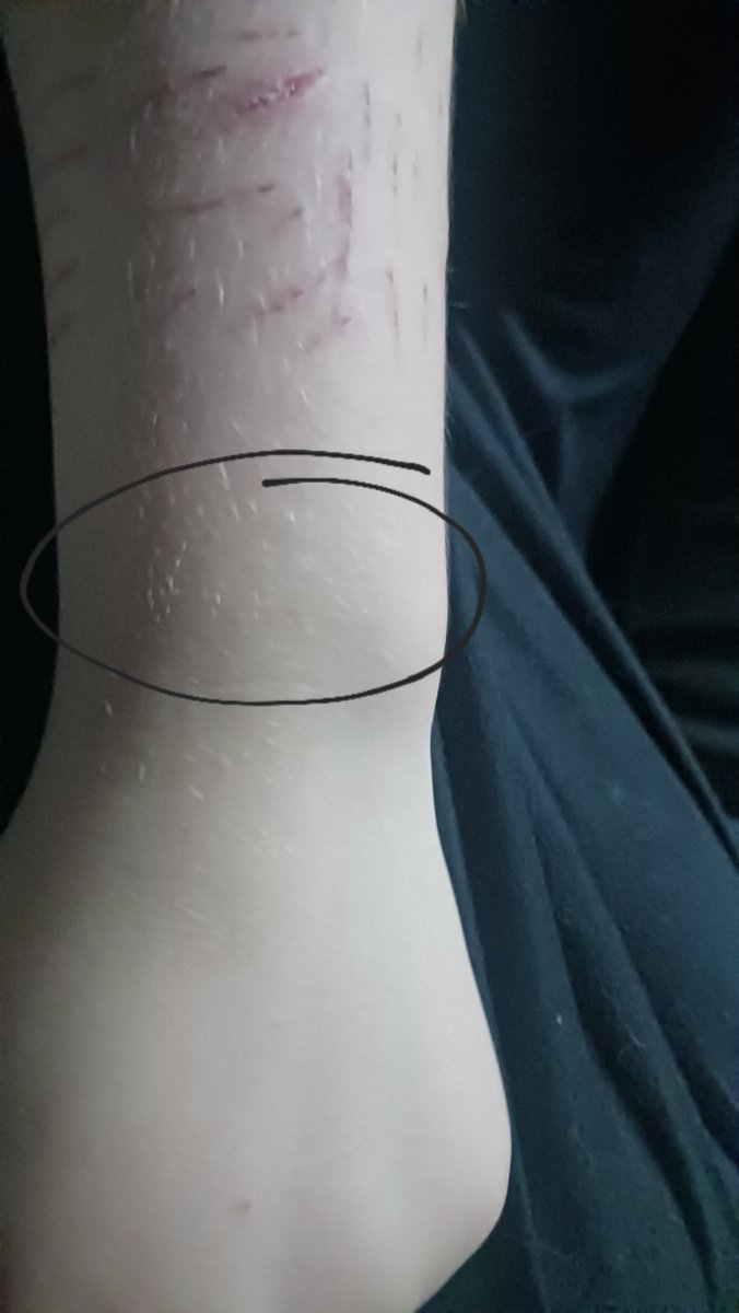 ⋆˚.⭒⋆Garfield of shedtwt ⋆⭒˚.⋆ tweet media