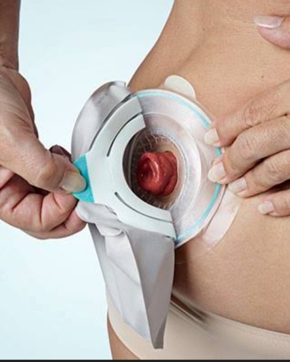 Aura, MD tweet media