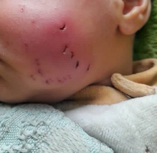 Dr. Yousef 🇵🇸 tweet media