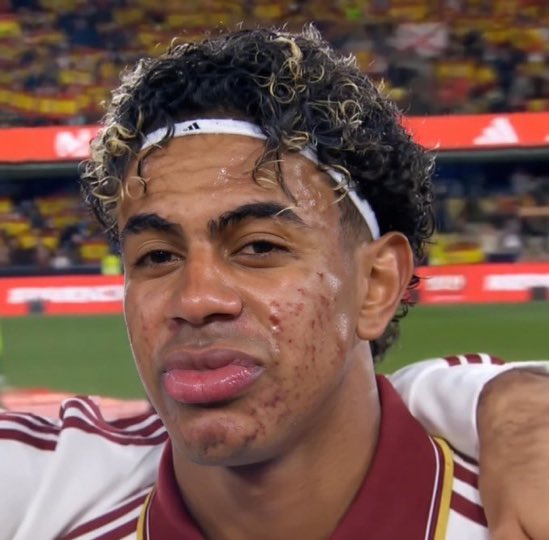 oye @Grok ponle el color de piel de Vinicius y los dientes de Ronaldinho