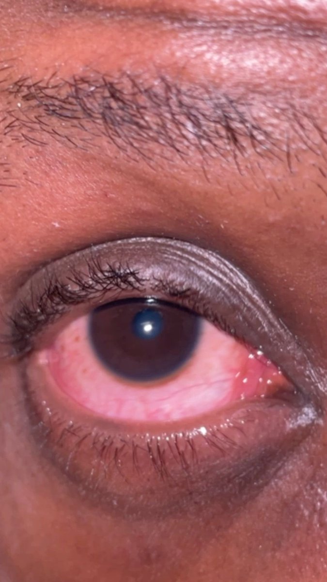 𝕭𝖔𝖞𝖋𝖗𝖎𝖊𝖓𝖉🦉 tweet media