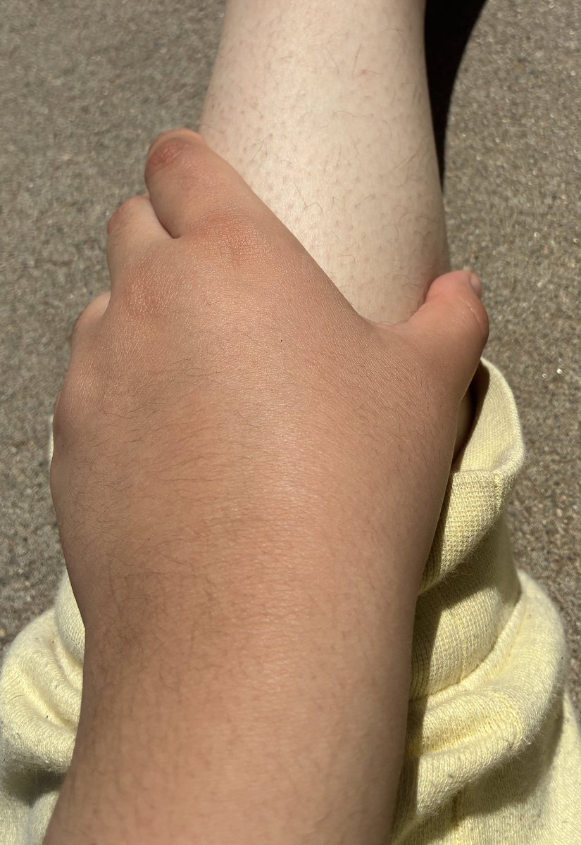 (17+ only) Alois of shtwt 🕷️🕊️🥀 tweet media