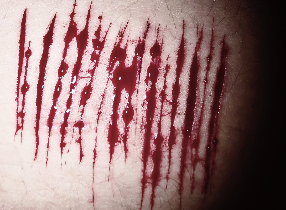 dazai of shedtwt ⚠︎ tweet media