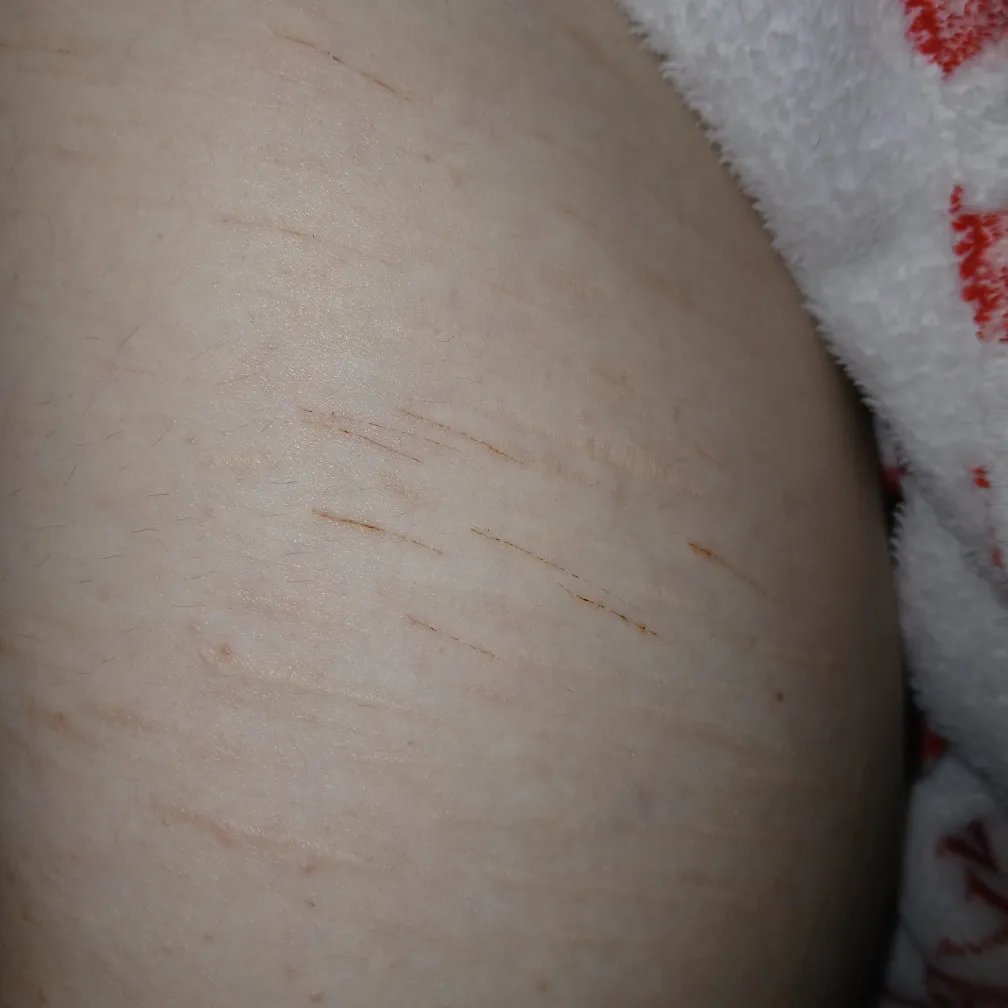 yatta of shedtwt tweet media