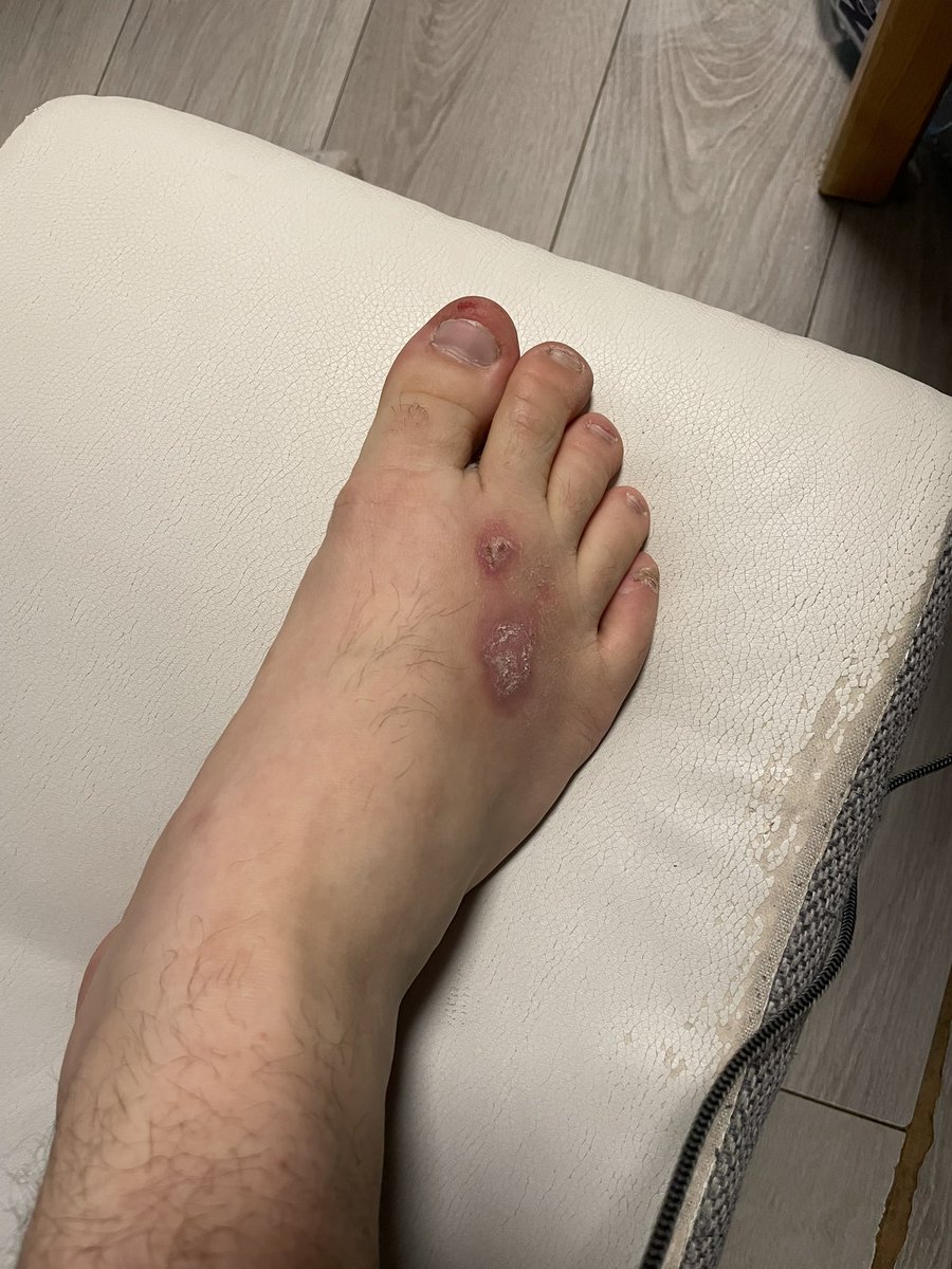 𝐓𝐨𝐱𝐢𝐜 𝐉𝐮𝐳𝐞𝐤🦠👀🇵🇱 tweet media