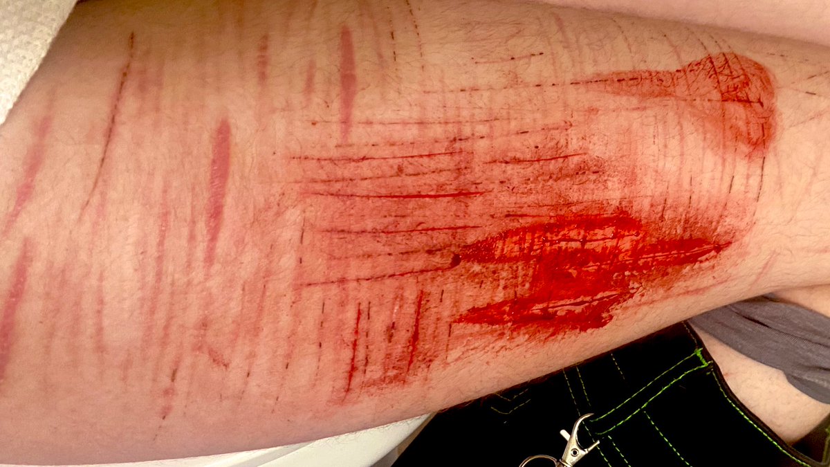 MEPHOJ LOVER OF SHTWT tweet media