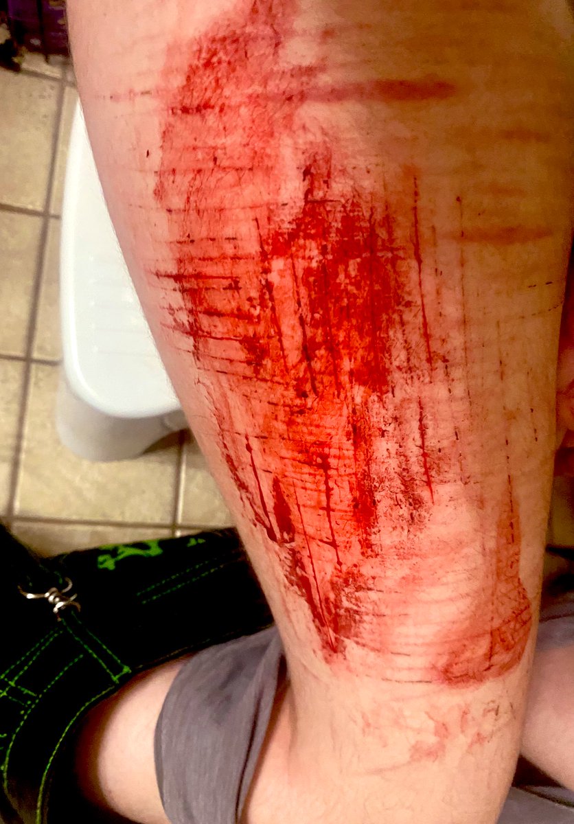 MEPHOJ LOVER OF SHTWT tweet media