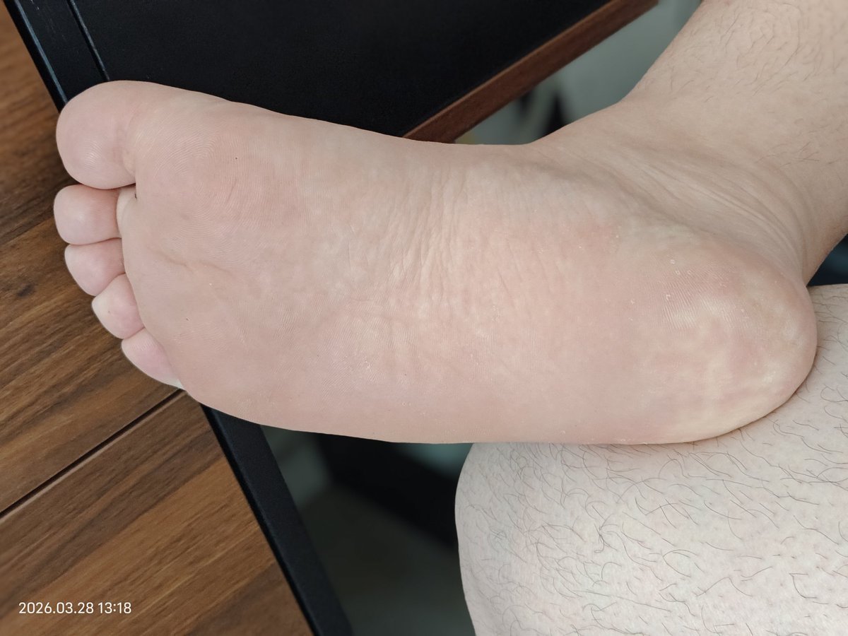 肉脚小猪 tweet media