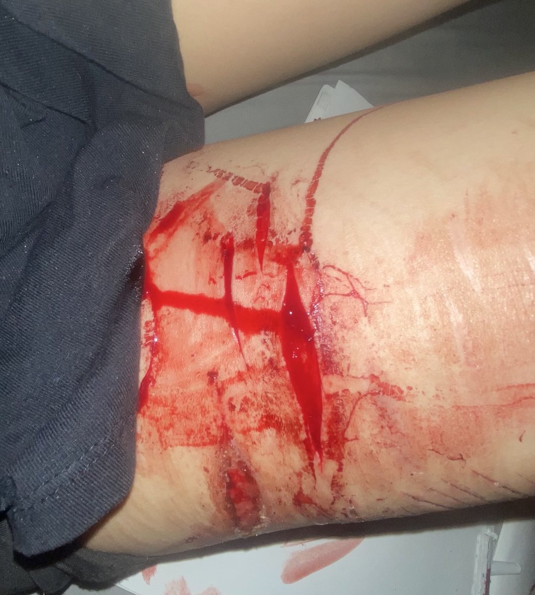 Dove † • Vittorino of shedtwt • † tweet media