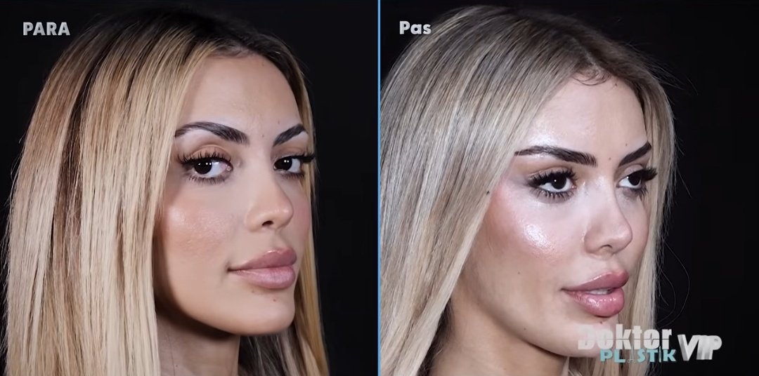 BBVIP ALB tweet media