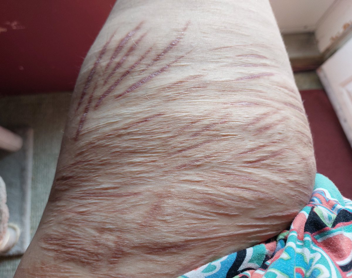 Flame Princess 🔥 tweet media