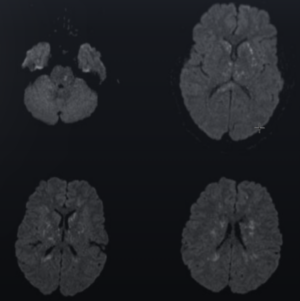 たのしい診断推論カフェ tweet media